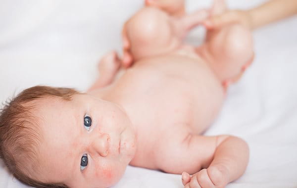 The Different Types Of Acne Acne Eucerin