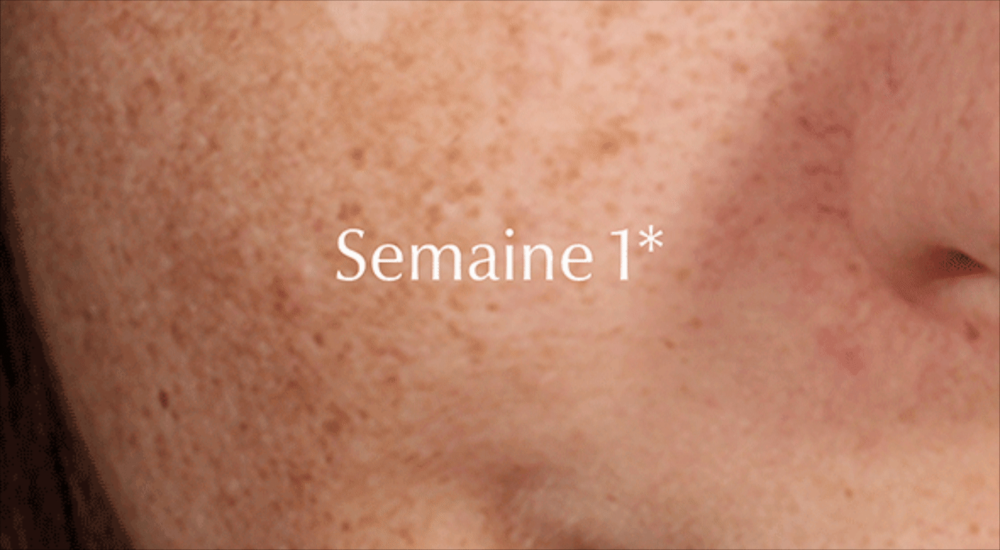 Comment fonctionne le Thiamidol et quels sont les résultats ? 