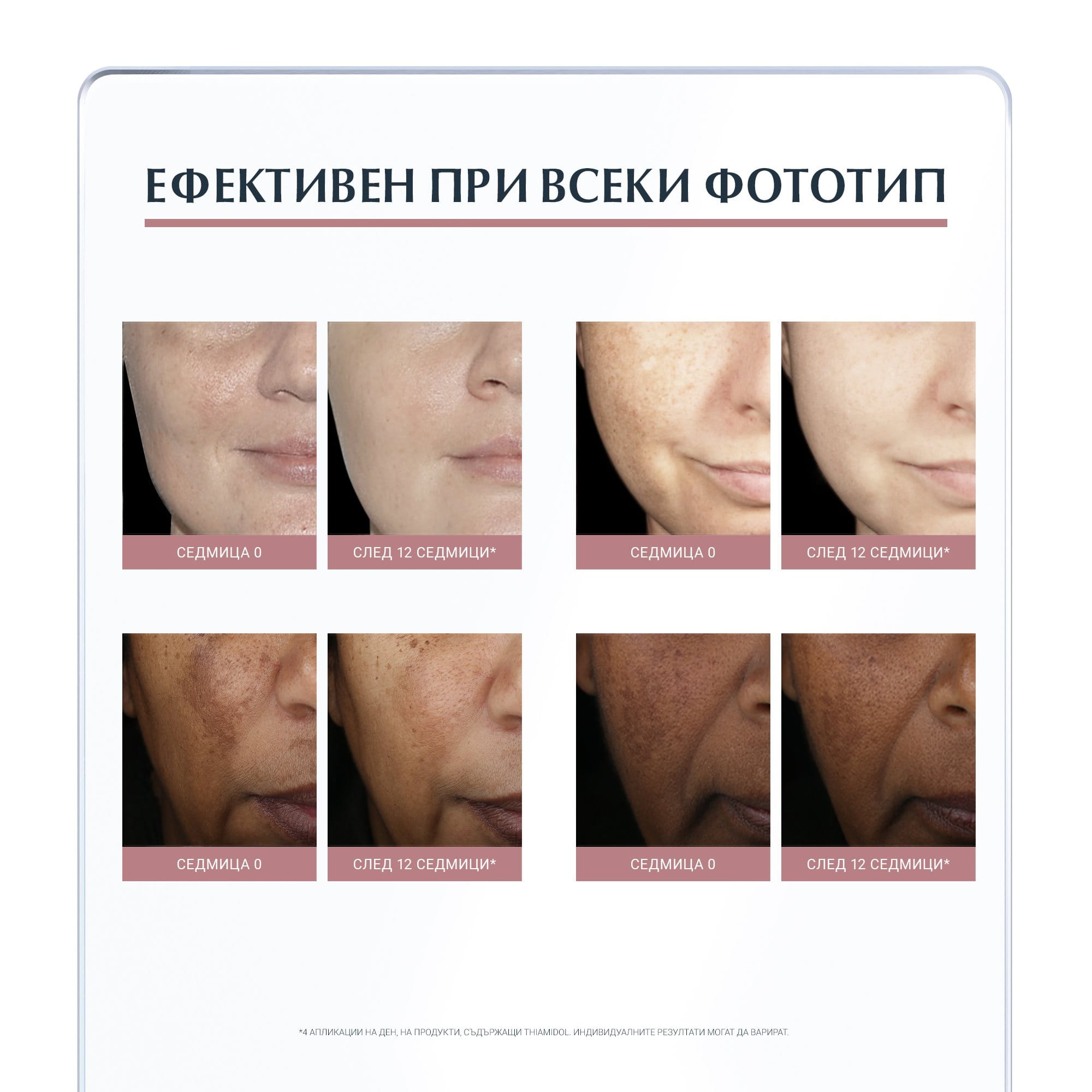Клиничните и дерматологични проучвания доказват много висока ефективност и отлична поносимост от всеки фототип кожа