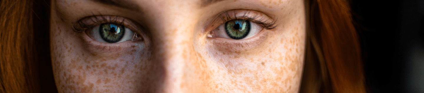 Girl with freckles on face