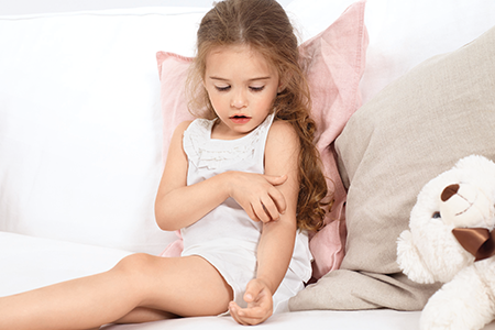 Atopijski dermatitis kod djece