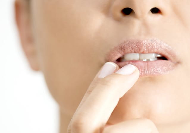 irritazione intorno alla bocca