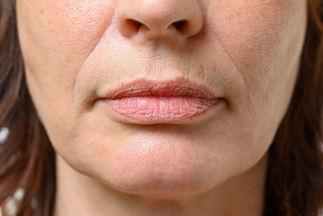 Rughe della marionetta foto