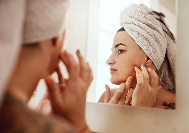 immagine di foruncoli sul mento