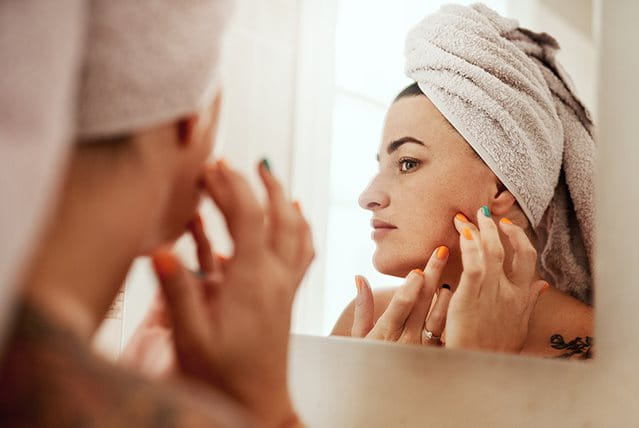 immagine di foruncoli sul mento