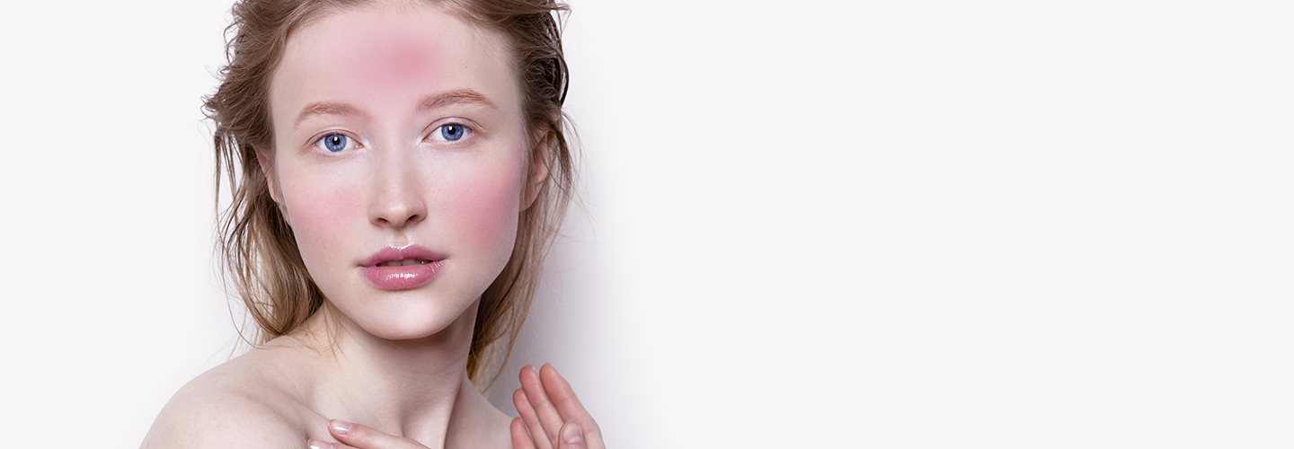 Pelle del viso irritata