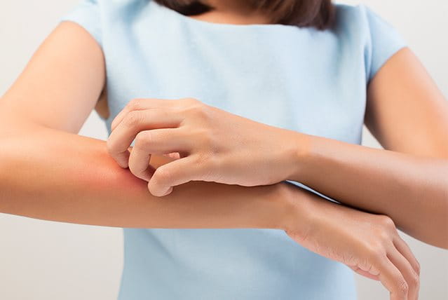 Prurito alle braccia