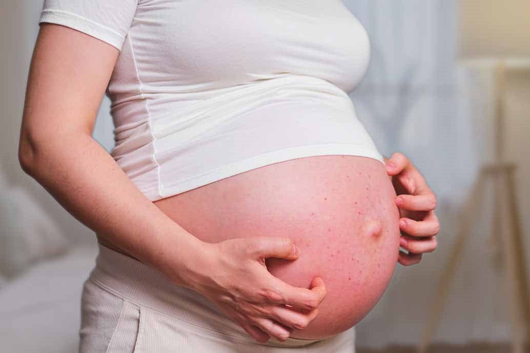 prurito in gravidanza con bolle sulla pancia