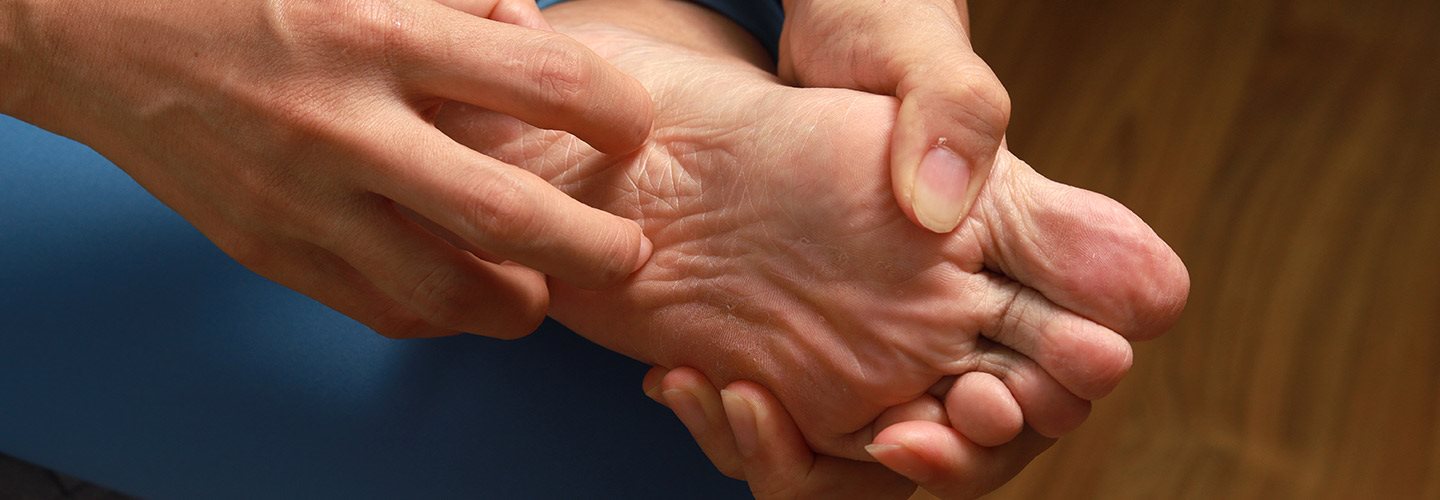 Prurito sotto i piedi