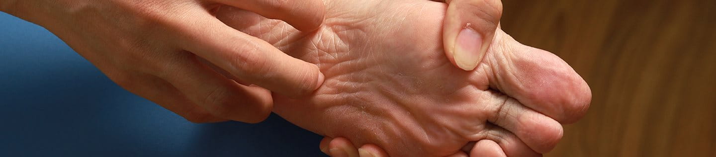 Prurito sotto i piedi