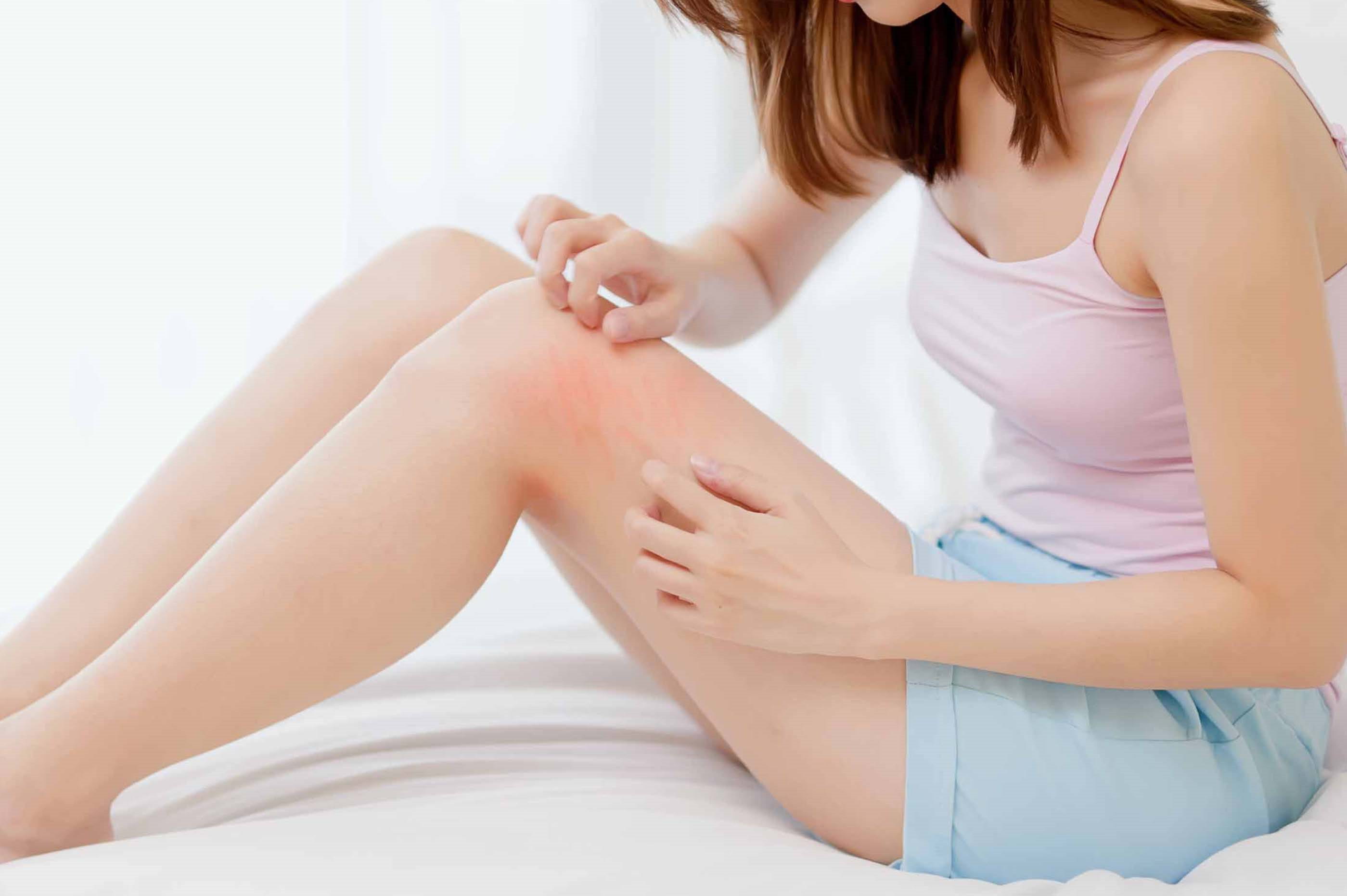 pelle secca gambe sintomi