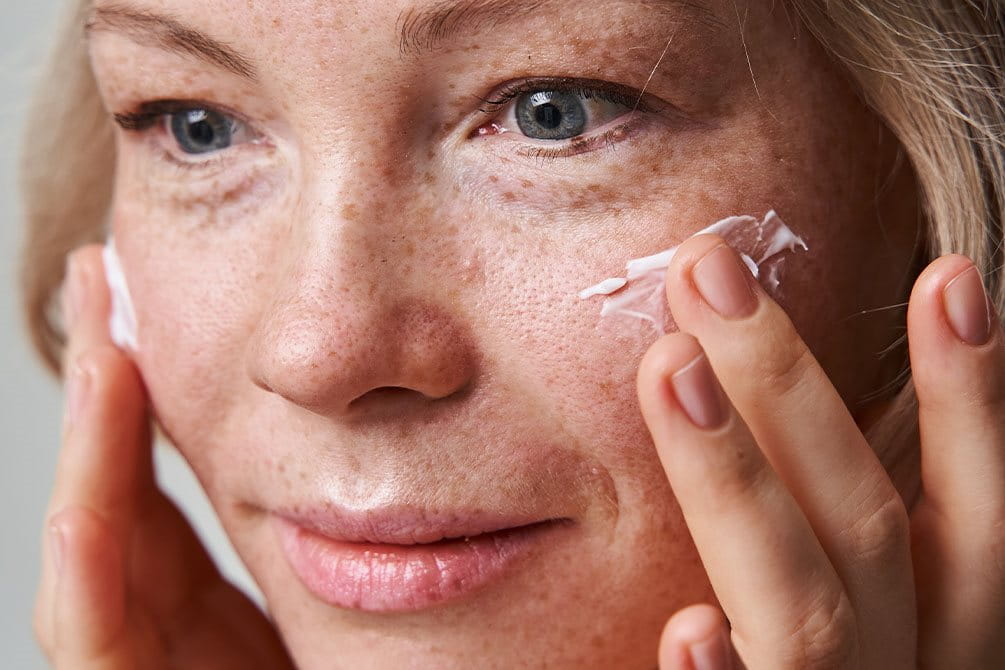 migliore crema per cheratosi attinica