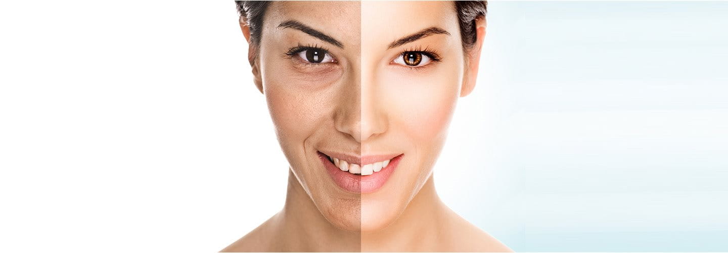 Pelle spenta e grigia