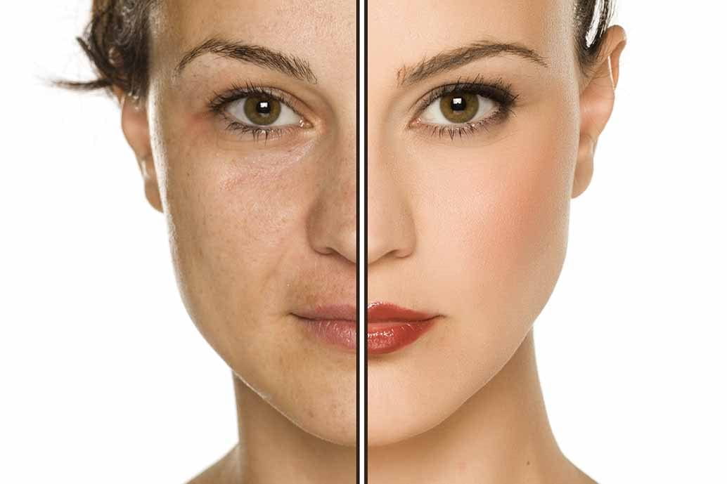 pelle che perde idratazione e luminosità