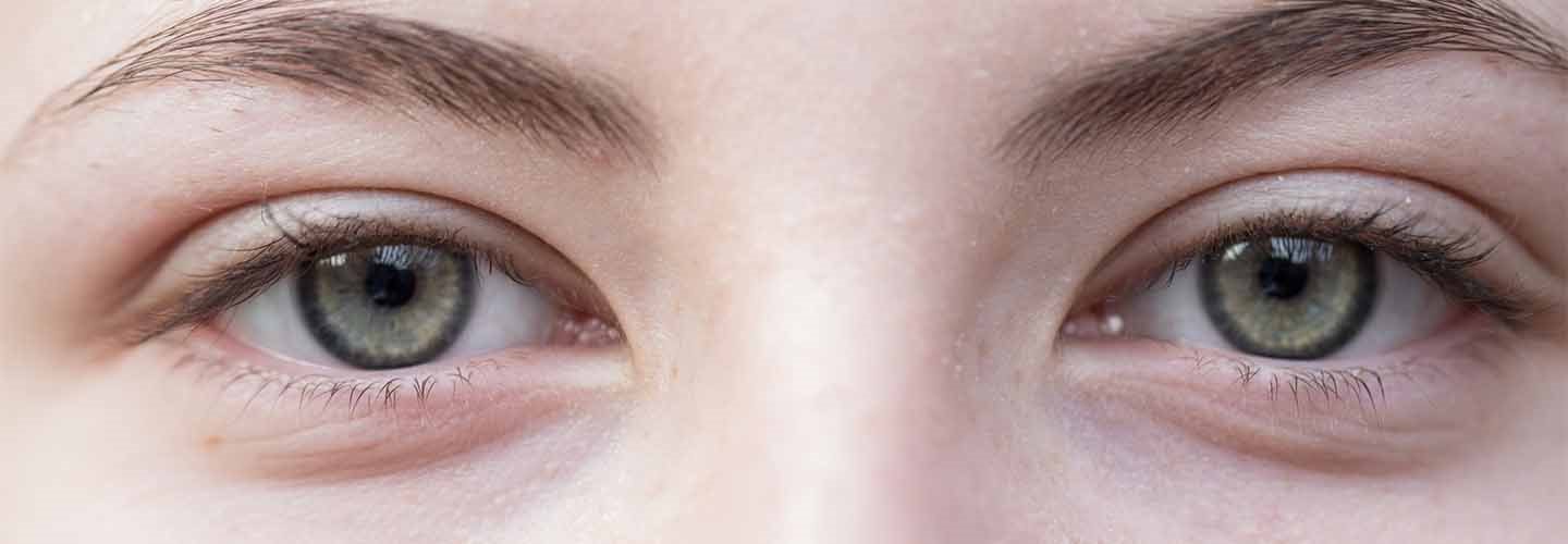 pelle del contorno occhi disidratata