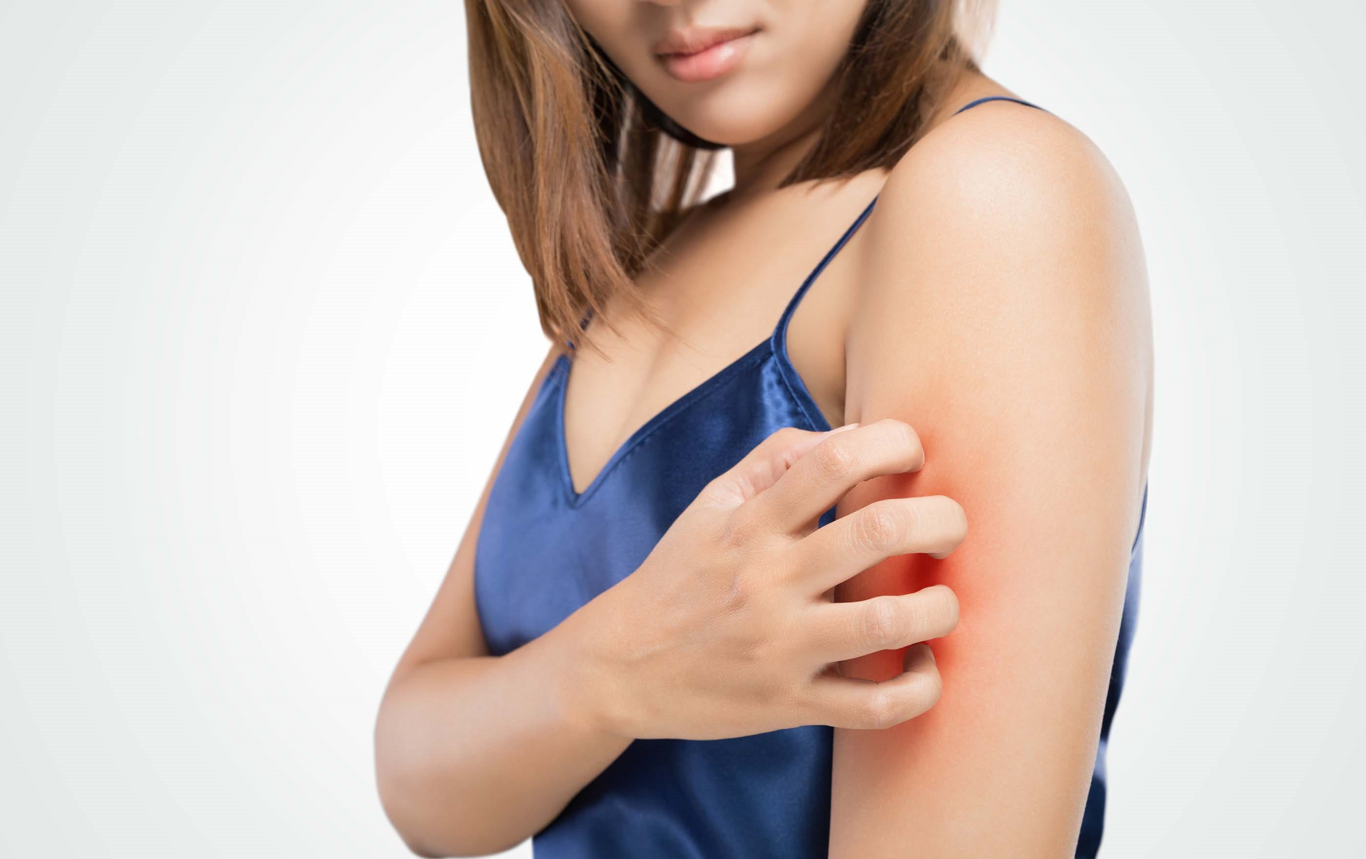psoriasi da stress sintomi