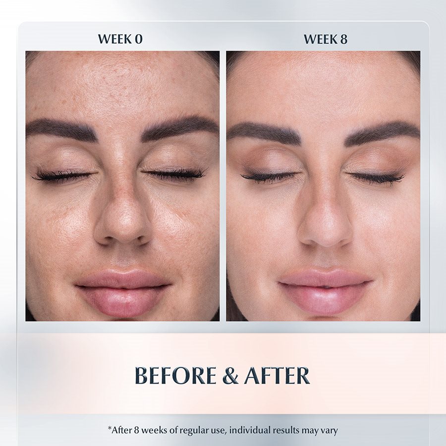 eucerin for dark neck