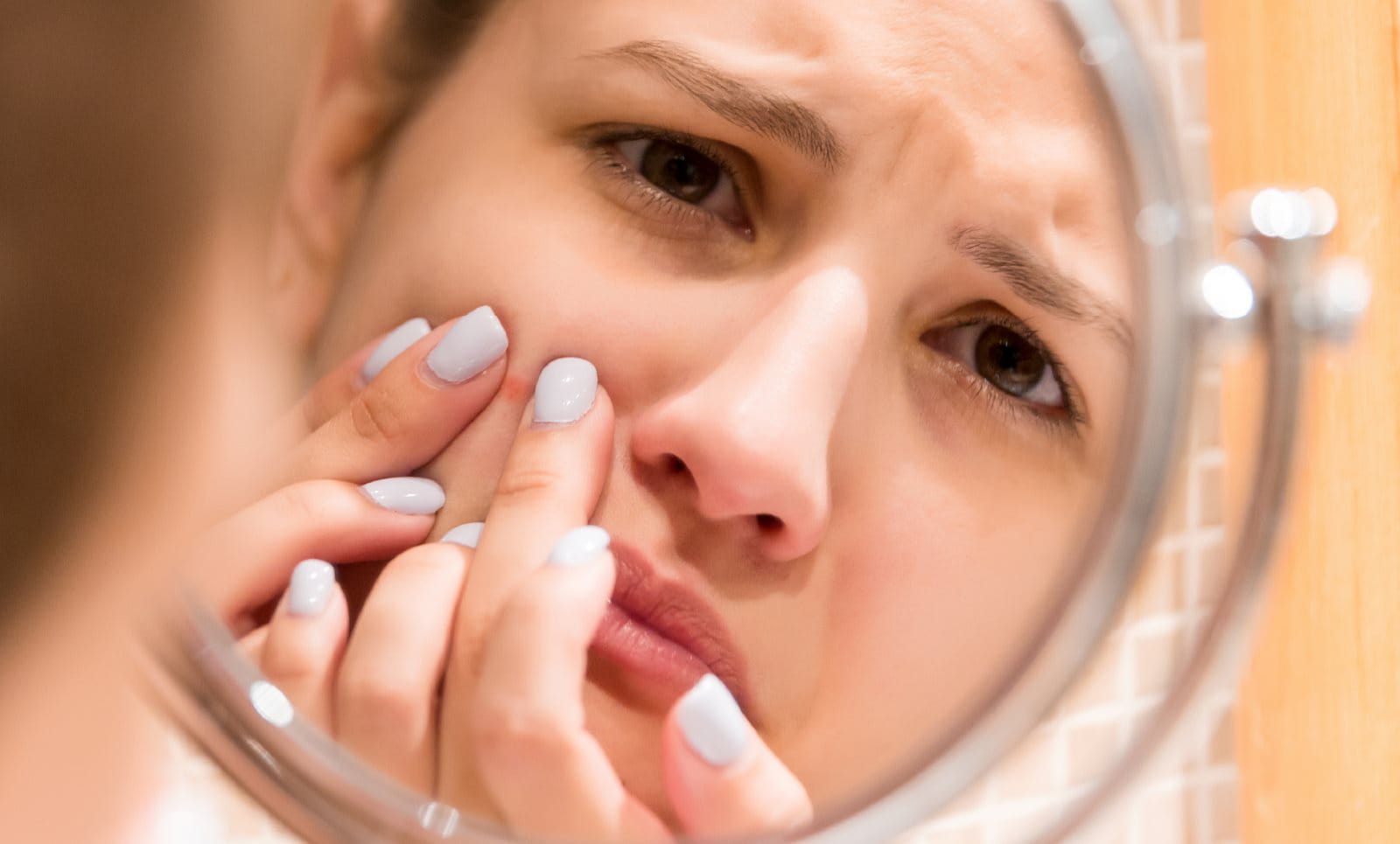 Acne Picking