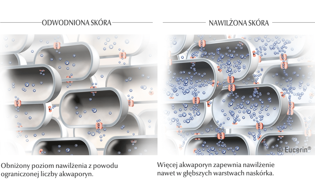 Ilustracje nawilżonej i wysuszonej skóry