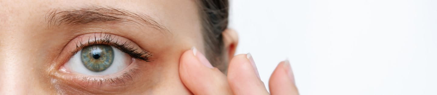 Cienie pod oczami przyczyny