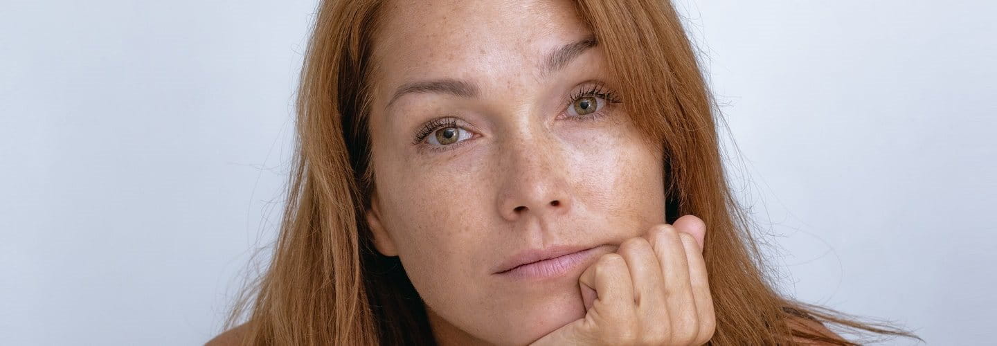 domowe sposoby na przebarwienia na twarzy