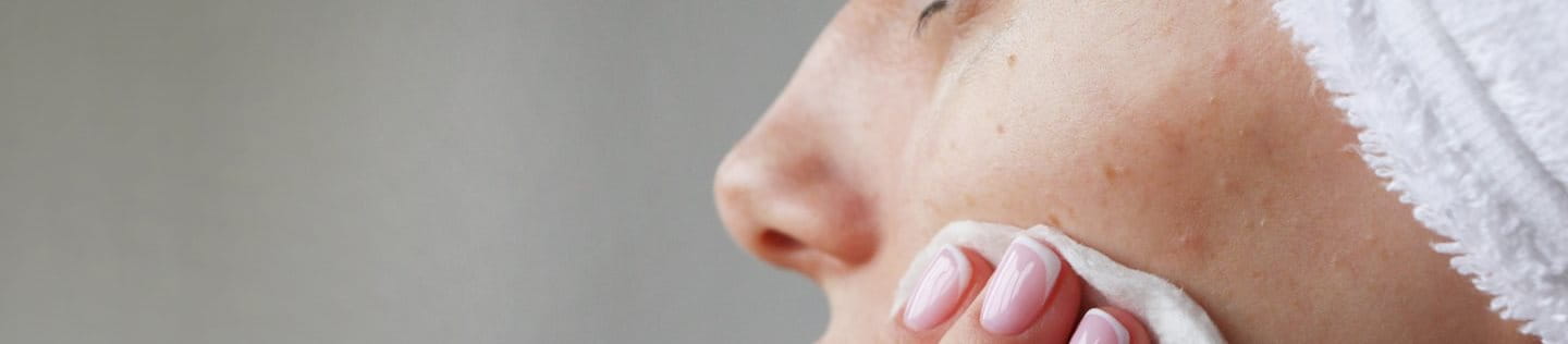 Co na krosty na twarzy