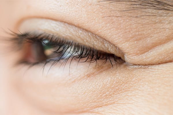 kurze łapki zmarszczki