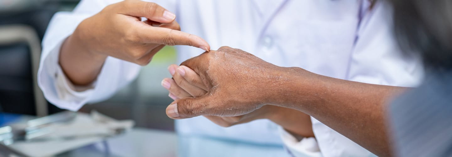 Łuszczenie się skóry na twarzy