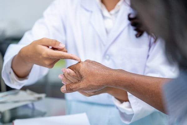 Łuszczenie się skóry na twarzy