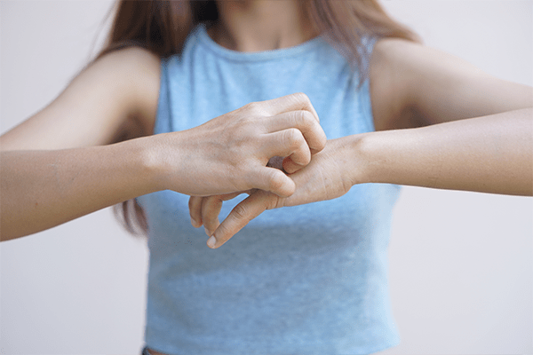 potówki u dorosłych