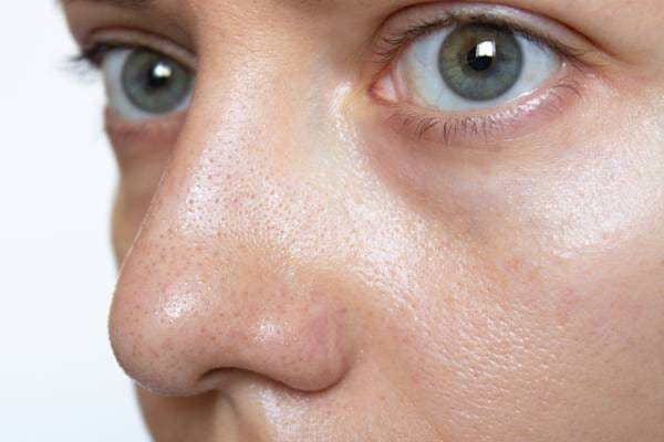 Sebum