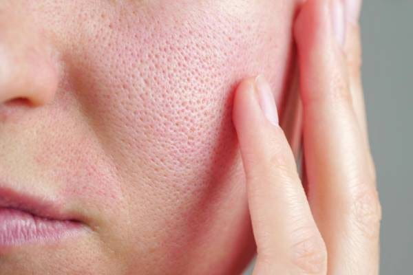 Sebum
