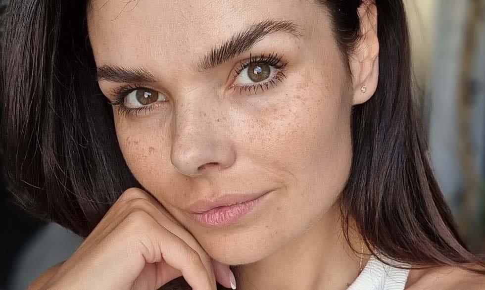 Przebarwienia u Moniki