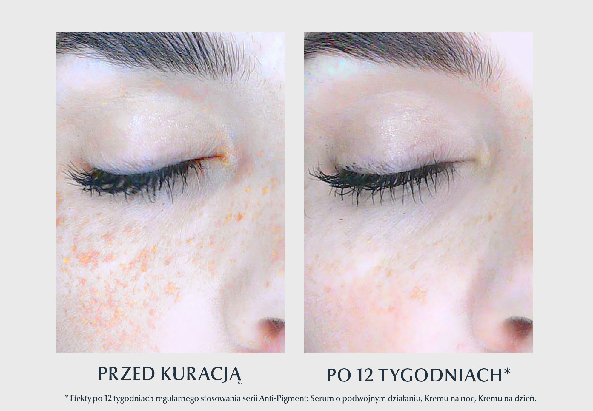 efekty kuracji Anti-Pigment