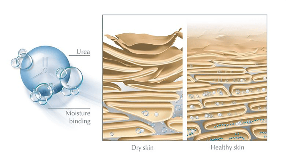 урея златен стандарт в грижата за сухата кожа