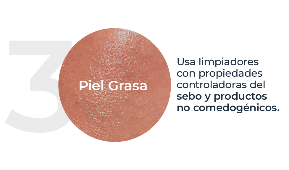 Piel Grasa