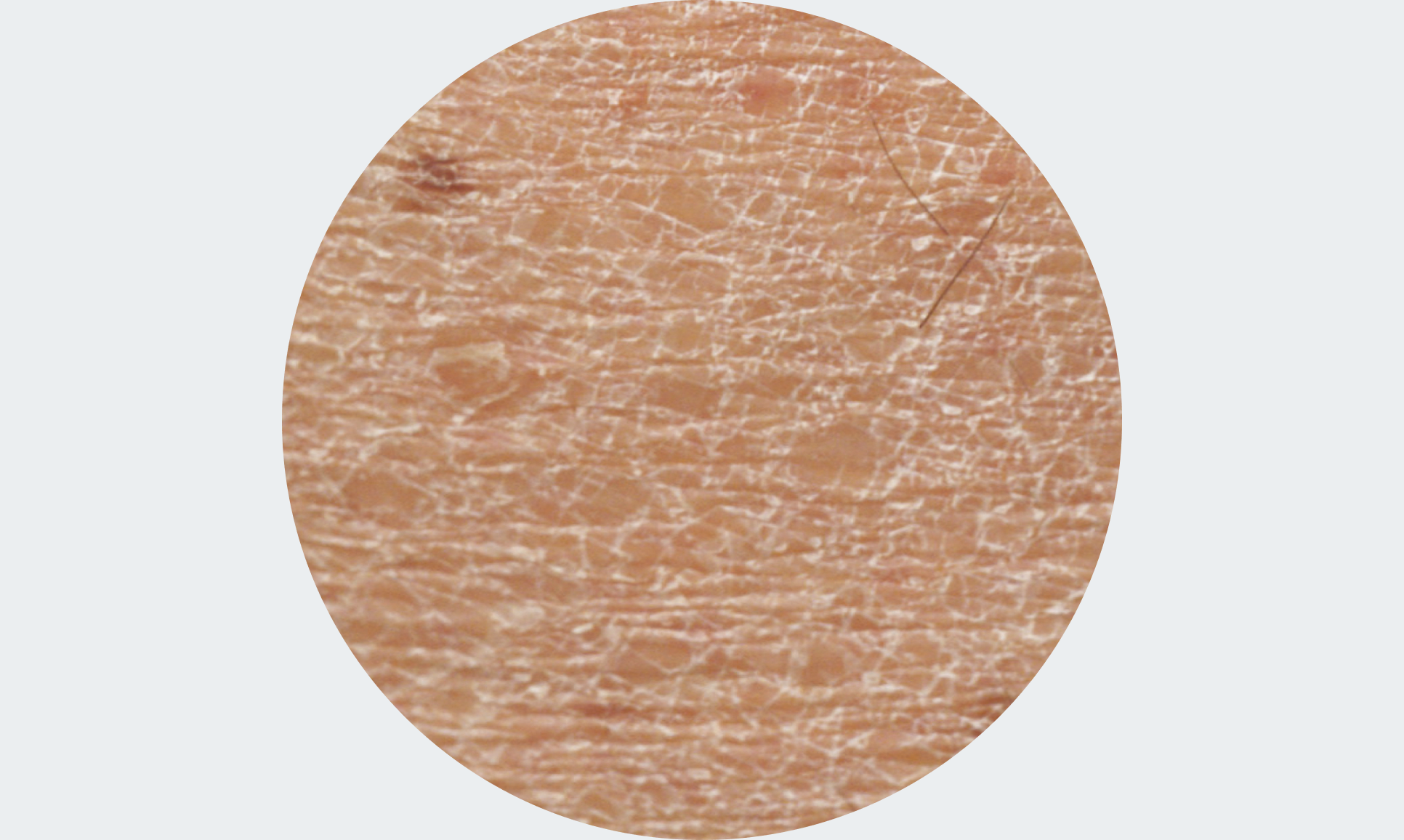 UreaRepairPLUS pour les peaux sèches à très sèches