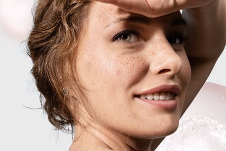 Manchas na pele causadas pelo sol