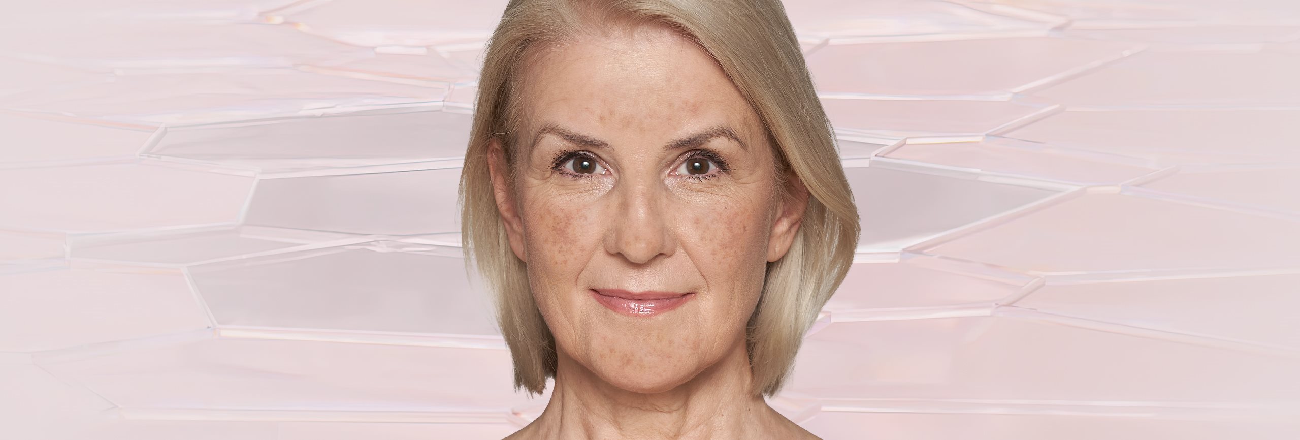 Manchas en la piel causadas por la edad