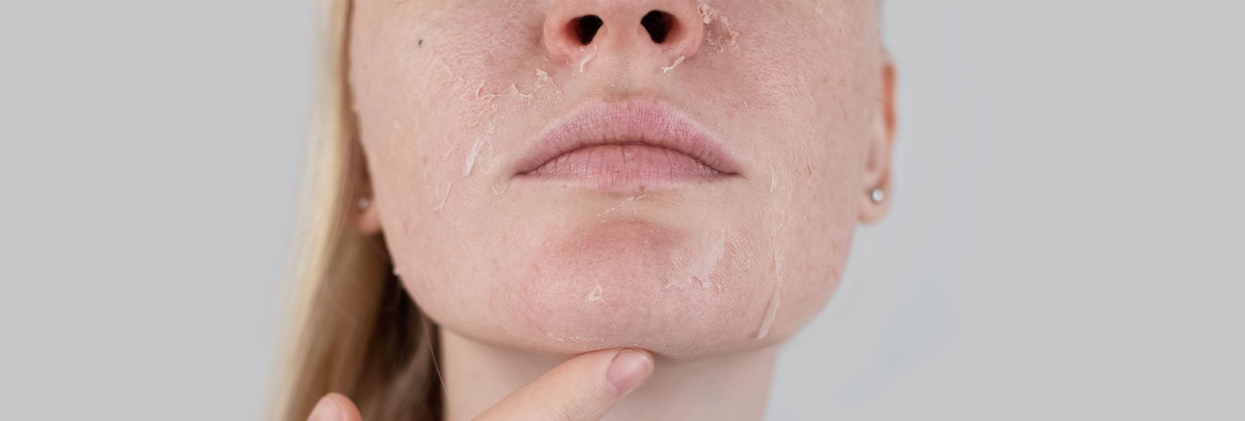 pele ressecada no rosto