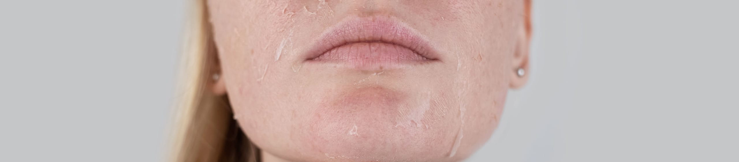 pele ressecada no rosto