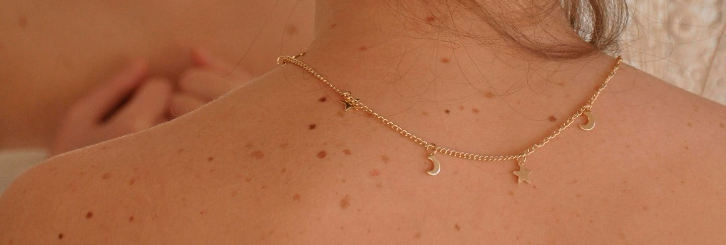 espinillas-granos-en-la-espalda-causas-tratamiento