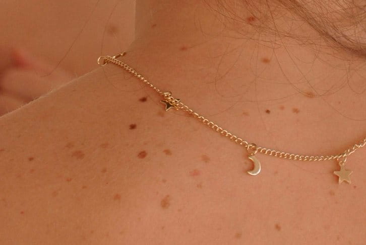 espinillas-granos-en-la-espalda-causas-tratamiento