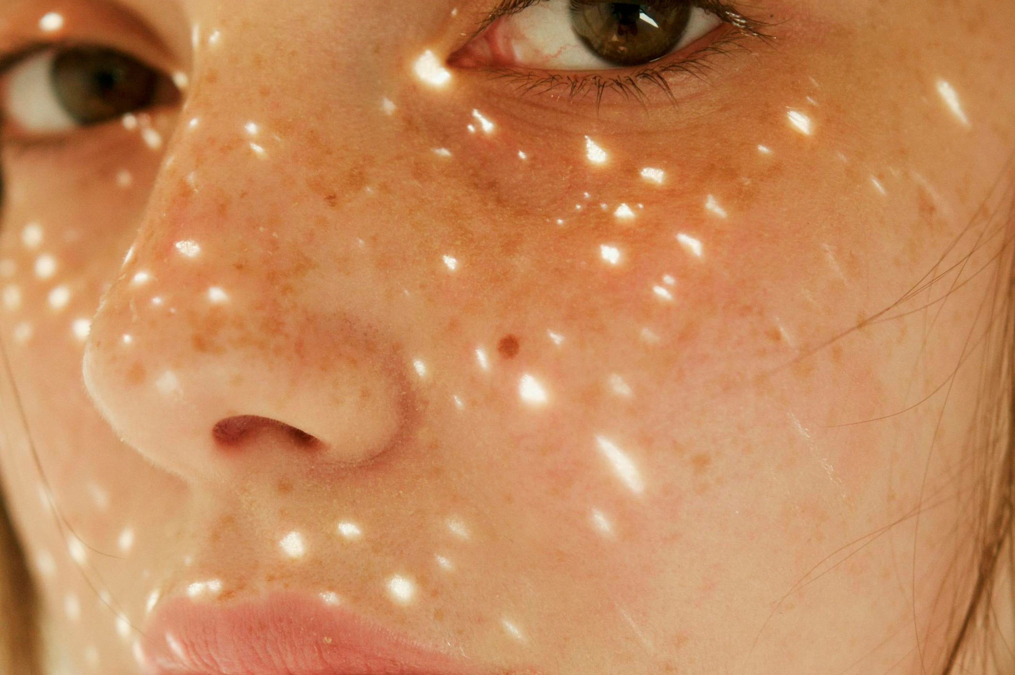 que-es-la-melanina-como-protege-frente-al-sol