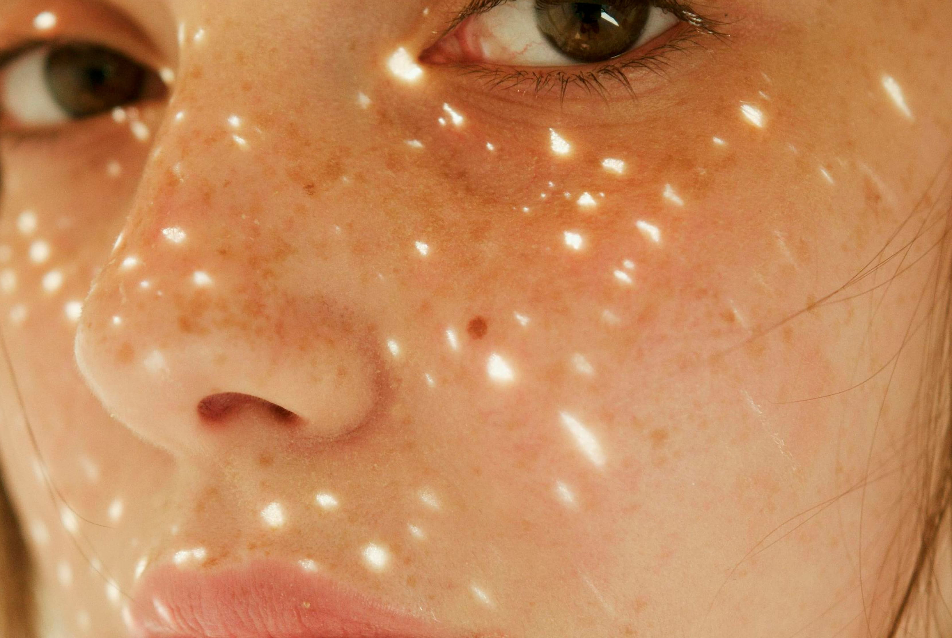 que-es-la-melanina-como-protege-frente-al-sol