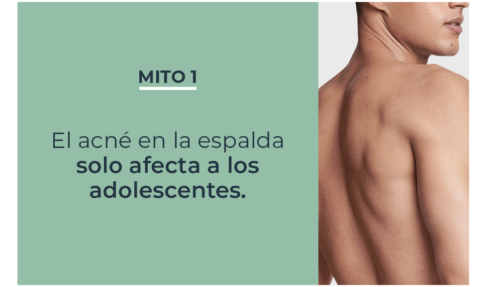 Mitos y verdades sobre acné en la espalda