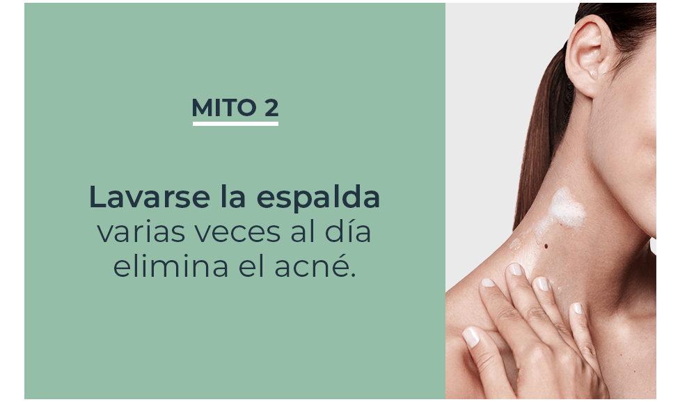 Mitos y verdades sobre acné en la espalda