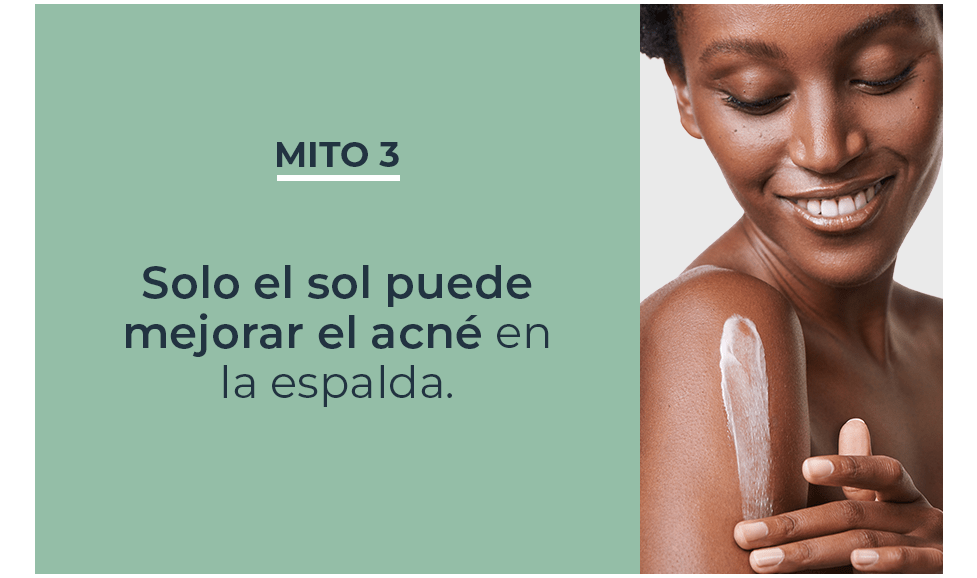 Mitos y verdades sobre acné en la espalda