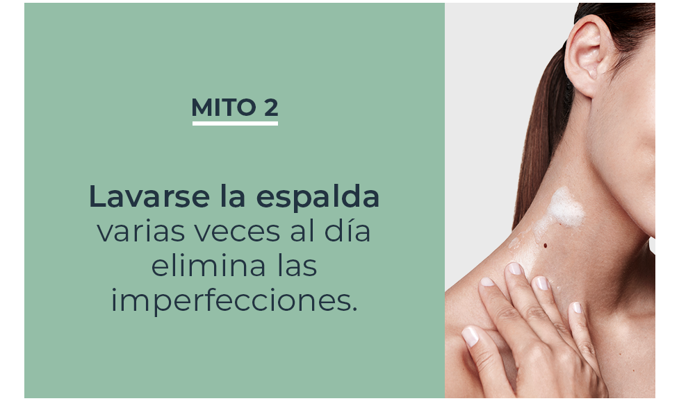 Mitos y verdades sobre la imperfecciones en la espalda