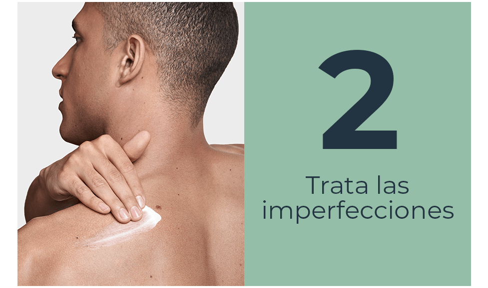 Trata las imperfecciones